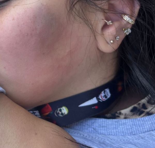 Funcionario municipal que agredió a contribuyente en Goicoechea enfrentaría despido